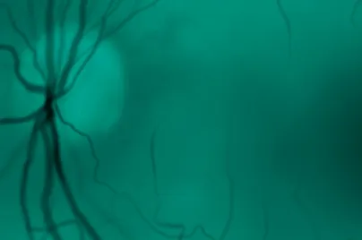 Ophthalmology